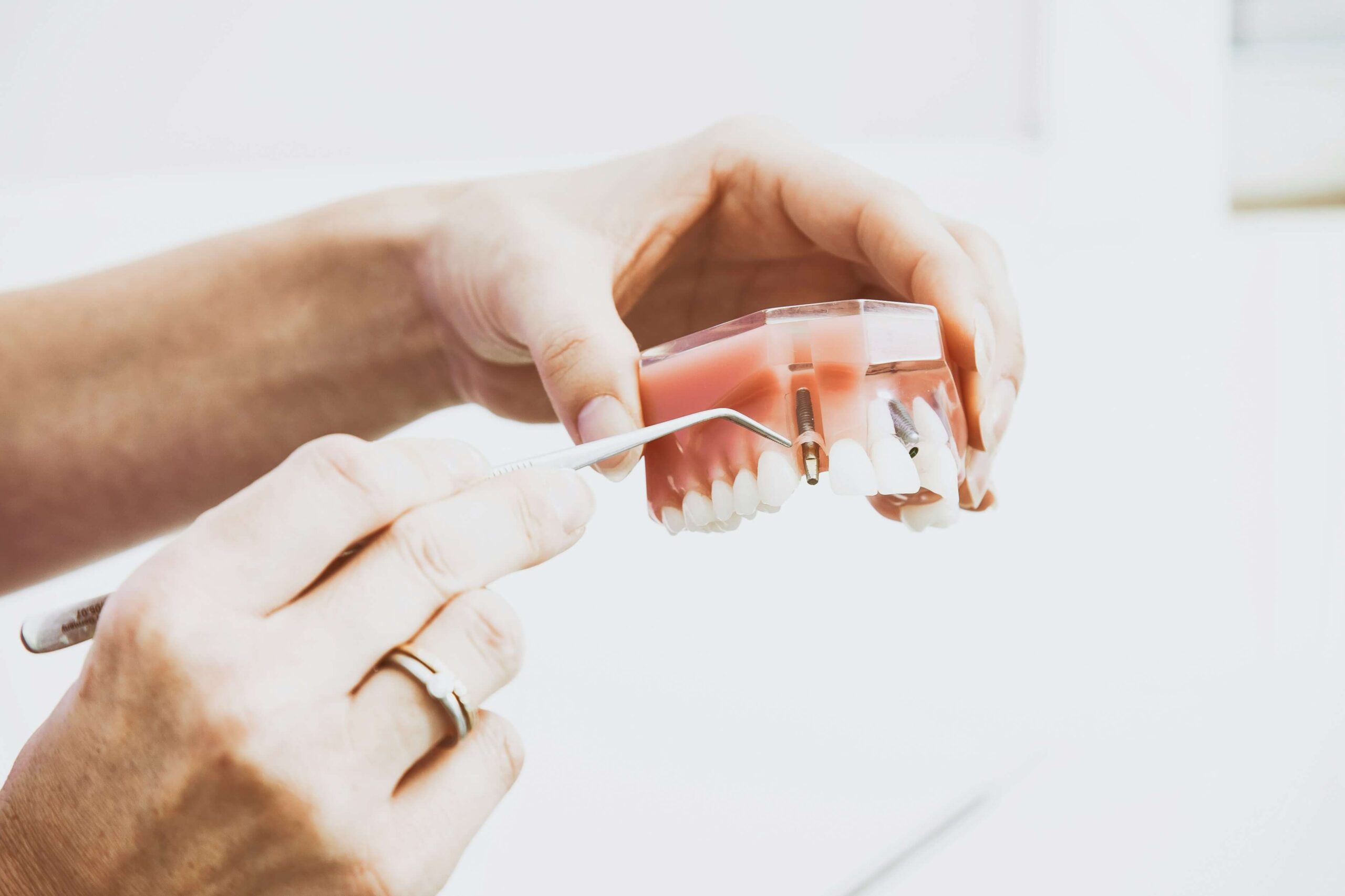 Demostración con modelo dental de colocación de implantes dentales