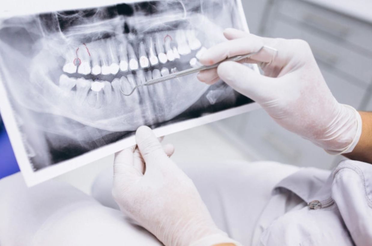 radiografia dental